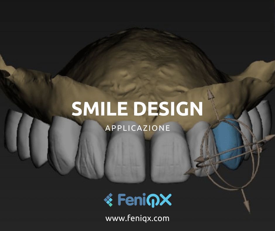 Post2FeniqxMag